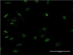 HMGB2 Antibody (X1), Novus Biologicals 0.1 mg | Buy Online | Novus Biologicals | Fisher Scientific