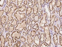 HMGCL Antibody, Novus Biologicals 100 &mu;g, Unconjugated:Antibodies, Polyclonal