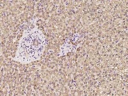HMGCL Antibody, Novus Biologicals 100 &mu;g, Unconjugated:Antibodies, Polyclonal