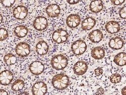 HMGCS1 Antibody, Novus Biologicals 50 &mu;g, Unconjugated:Antibodies, Polyclonal