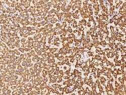 HMGCS1 Antibody, Novus Biologicals 50 &mu;g, Unconjugated:Antibodies, Polyclonal