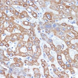 HMGCS2 Rabbit anti-Human, Mouse, Rat, Clone: 5T5T3, Novus Biologicals:Antibodies:Primary