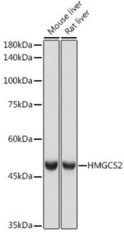 HMGCS2 Rabbit anti-Human, Mouse, Rat, Clone: 5T5T3, Novus Biologicals:Antibodies:Primary