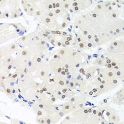 RIG-I Rabbit anti-Human, Polyclonal, Novus Biologicals:Antibodies:Primary