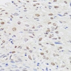 RIG-I Rabbit anti-Human, Polyclonal, Novus Biologicals 20 &mu;L; Unconjugated:Antibodies,