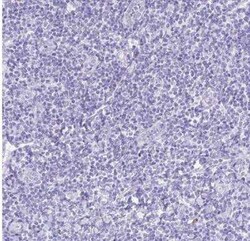 HMP19 Antibody, Novus Biologicals 25 &mu;L, Unconjugated:Antibodies, Polyclonal