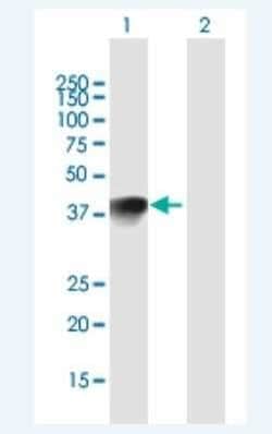 HMX1 Antibody, Novus Biologicals 50 &mu;g | Buy Online | Novus Biologicals | Fisher Scientific