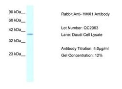 HMX1 Rabbit anti-Human, Polyclonal, Novus Biologicals 0.1 mL; Unconjugated:Antibodies,