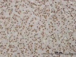 HMX2 Antibody (1D7), Novus Biologicals 0.1 mg | Buy Online | Novus Biologicals | Fisher Scientific