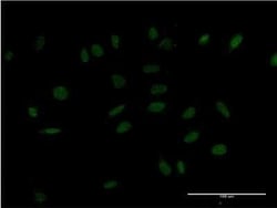 HMX2 Antibody (2D2), Novus Biologicals 0.1 mg, Unconjugated:Antibodies,