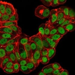 HNF-3 alpha/FoxA1 Antibody (FOXA1/2230R) - Azide and BSA Free, Novus Biologicals