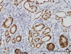 HNF-3 beta/FoxA2 Antibody (1C7), Novus Biologicals 0.1 mg, Unconjugated:Anticuerpos