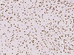 HNF-6/ONECUT1 Antibody, Novus Biologicals:Antibodies:Primary Antibodies