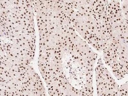 HNF-6/ONECUT1 Antibody, Novus Biologicals:Antibodies:Primary Antibodies
