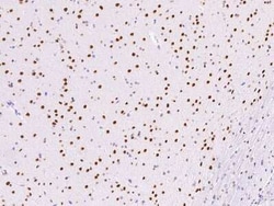 HNF-6/ONECUT1 Antibody, Novus Biologicals:Antibodies:Primary Antibodies