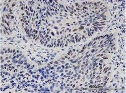 TCF-2/HNF-1 beta Antibody (4A1), Novus Biologicals 0.1 mg | Buy Online | Novus Biologicals | Fisher Scientific