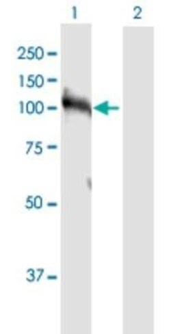 HNRNPUL1 Antibody, Novus Biologicals 0.1 mg | Buy Online | Novus Biologicals | Fisher Scientific