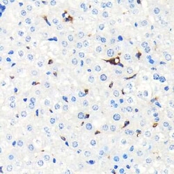 HO-1/HMOX1/HSP32 Rabbit anti-Human, Mouse, Rat, Clone: 3L2U4, Novus Biologicals