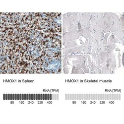 HO-1/HMOX1/HSP32 Mouse anti-Human, Clone: CL11661, Novus Biologicals 100 &mu;g | Buy Online | Novus Biologicals | Fisher Scientific