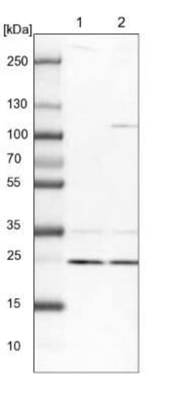 HO-2/HMOX2 Antibody, Novus Biologicals 0.1 mL | Buy Online | Novus Biologicals | Fisher Scientific