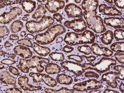 HOGA1 Antibody, Novus Biologicals 100 &mu;g; Unconjugated:Antibodies, Polyclonal