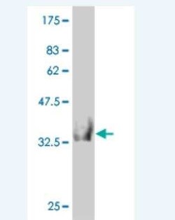 HOOK2 Antibody (1E10), Novus Biologicals 0.1 mg | Buy Online | Novus Biologicals | Fisher Scientific