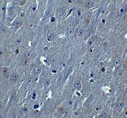 HOOK3 Antibody - BSA Free, Novus Biologicals 0.1 mg; Unconjugated:Antibodies,