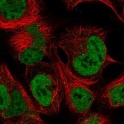 HOXA10 Rabbit anti-Human, Polyclonal, Novus Biologicals 25 &mu;g | Buy Online | Novus Biologicals | Fisher Scientific