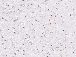 HOXA10 Antibody, Novus Biologicals 100 &mu;g; Unconjugated:Antibodies,