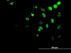 HOXA11 Antibody (5A3), Novus Biologicals 0.1 mg | Buy Online | Novus Biologicals | Fisher Scientific