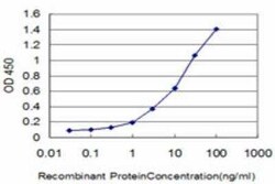 HOXA11 Antibody (7F8), Novus Biologicals 0.1 mg | Buy Online | Novus Biologicals | Fisher Scientific