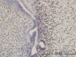 HOXA11 Antibody (8B8), Novus Biologicals 0.1 mg | Buy Online | Novus Biologicals | Fisher Scientific