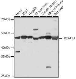HOXA13 Rabbit anti-Human, Mouse, Rat, Clone: 5K0D5, Novus Biologicals 100 &mu;g | Buy Online | Novus Biologicals | Fisher Scientific