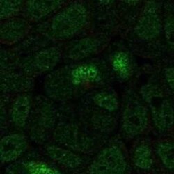 HOXA13 Rabbit anti-Human, Polyclonal, Novus Biologicals 100 &mu;g; Unconjugated:Antibodies,