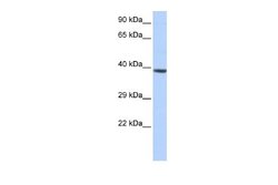 HOXA2 Rabbit anti-Human, Polyclonal, Novus Biologicals 0.1ml; Unconjugated:Antibodies,