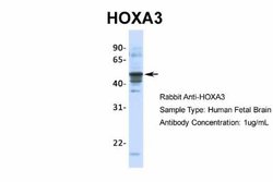 HOXA3 Rabbit anti-Human, Mouse, Polyclonal, Novus Biologicals 0.1 mL; Unconjugated:Antibodies,