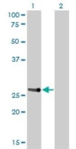 HOXA7 Antibody (2F2), Novus Biologicals 0.1 mg | Buy Online | Novus Biologicals | Fisher Scientific