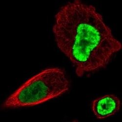HOXB13 Antibody, Novus Biologicals 25 &mu;L, Unconjugated:Antibodies, Polyclonal