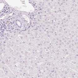 HOXB13 Antibody, Novus Biologicals 25 &mu;L, Unconjugated:Antibodies, Polyclonal