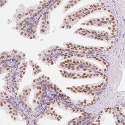 HOXB13 Antibody, Novus Biologicals 25 &mu;L, Unconjugated:Antibodies, Polyclonal