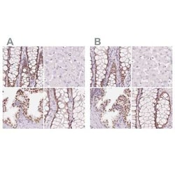 HOXB13 Antibody, Novus Biologicals 25 &mu;L, Unconjugated:Antibodies, Polyclonal