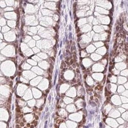 HOXB13 Antibody, Novus Biologicals 25 &mu;L, Unconjugated:Antibodies, Polyclonal