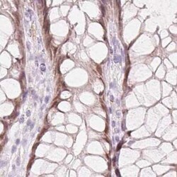 HOXB13 Antibody, Novus Biologicals 25 &mu;L, Unconjugated:Antibodies, Polyclonal