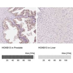 HOXB13 Antibody, Novus Biologicals 25 &mu;L | Buy Online | Novus Biologicals | Fisher Scientific