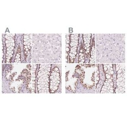 HOXB13 Antibody, Novus Biologicals 25 &mu;L | Buy Online | Novus Biologicals | Fisher Scientific