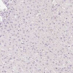 HOXB13 Antibody, Novus Biologicals 25 &mu;L | Buy Online | Novus Biologicals | Fisher Scientific