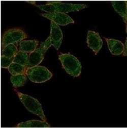 HOXB2 Mouse anti-Human, Clone: PCRP-HOXB2-1F2, Novus Biologicals 100 &mu;g;