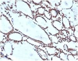 HOXB2 Mouse anti-Human, Clone: PCRP-HOXB2-1F2, Novus Biologicals 100 &mu;g;