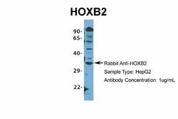 HOXB2 Rabbit anti-Human, Polyclonal, Novus Biologicals 0.1 mL | Buy Online | Novus Biologicals | Fisher Scientific