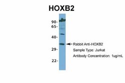 HOXB2 Rabbit anti-Human, Polyclonal, Novus Biologicals 0.1 mL | Buy Online | Novus Biologicals | Fisher Scientific